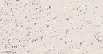 STK39 Recombinant Rabbit Monoclonal Antibody (6G7)