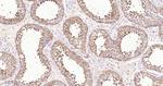 STK39 Antibody in Immunohistochemistry (Paraffin) (IHC (P))