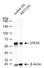 STK39 Antibody in Western Blot (WB)