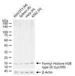 Formyl-Histone H2B (Lys109) Recombinant Rabbit Monoclonal Antibody (10D3)