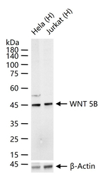 WNT5B Recombinant Rabbit Monoclonal Antibody (9H12)