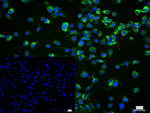 CXCL5 Recombinant Rabbit Monoclonal Antibody (2B7)
