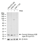 Formyl-Histone H2B (Lys121) Recombinant Rabbit Monoclonal Antibody (11C3)