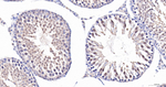 HMGN2 Antibody in Immunohistochemistry (Paraffin) (IHC (P))