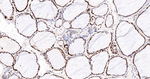 HMGN2 Antibody in Immunohistochemistry (Paraffin) (IHC (P))