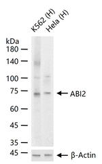 ABI2 Recombinant Rabbit Monoclonal Antibody (11H5)
