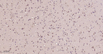 eIF3b Antibody in Immunohistochemistry (Paraffin) (IHC (P))
