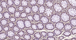 eIF3b Antibody in Immunohistochemistry (Paraffin) (IHC (P))