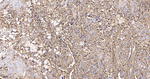 HLA-F Antibody in Immunohistochemistry (Paraffin) (IHC (P))