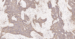 HLA-F Antibody in Immunohistochemistry (Paraffin) (IHC (P))
