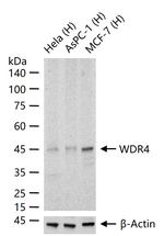 WDR4 Antibody in Western Blot (WB)