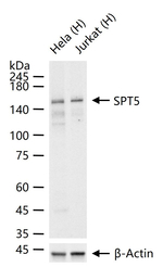 SPT5 Antibody in Western Blot (WB)