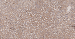 LCAT Recombinant Rabbit Monoclonal Antibody (11E10)