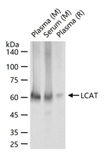 LCAT Antibody in Western Blot (WB)