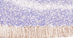 LGI1 Recombinant Rabbit Monoclonal Antibody (7B9)