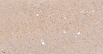 LGI1 Antibody in Immunohistochemistry (Paraffin) (IHC (P))
