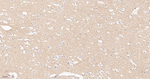 LGI1 Antibody in Immunohistochemistry (Paraffin) (IHC (P))