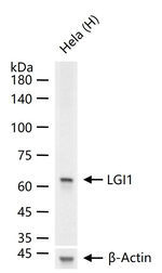 LGI1 Antibody in Western Blot (WB)