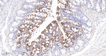 HMGCS2 Antibody in Immunohistochemistry (Paraffin) (IHC (P))