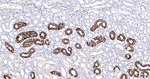 HMGCS2 Antibody in Immunohistochemistry (Paraffin) (IHC (P))