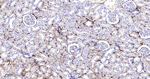 HMGCS2 Antibody in Immunohistochemistry (Paraffin) (IHC (P))