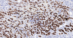 HMGCS2 Recombinant Rabbit Monoclonal Antibody (18G13)