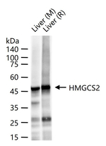 HMGCS2 Antibody in Western Blot (WB)