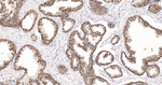 Arginase 2 Antibody in Immunohistochemistry (Paraffin) (IHC (P))