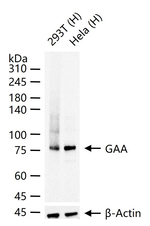 GAA Recombinant Rabbit Monoclonal Antibody (3H15)
