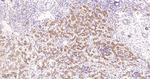 RACGAP1 Antibody in Immunohistochemistry (Paraffin) (IHC (P))