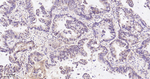 RACGAP1 Antibody in Immunohistochemistry (Paraffin) (IHC (P))