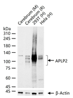 APLP2 Recombinant Rabbit Monoclonal Antibody (5F2)