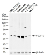 VEGFD Recombinant Rabbit Monoclonal Antibody (10B8)