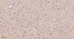 GOT2 Antibody in Immunohistochemistry (Paraffin) (IHC (P))