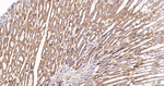 GOT2 Antibody in Immunohistochemistry (Paraffin) (IHC (P))