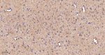 GOT2 Antibody in Immunohistochemistry (Paraffin) (IHC (P))