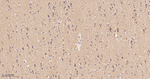 GOT2 Recombinant Rabbit Monoclonal Antibody (6E5)