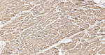 GOT2 Antibody in Immunohistochemistry (Paraffin) (IHC (P))