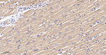 GOT2 Antibody in Immunohistochemistry (Paraffin) (IHC (P))