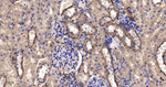 GOT2 Antibody in Immunohistochemistry (Paraffin) (IHC (P))