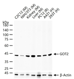GOT2 Antibody in Western Blot (WB)