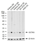 DCTN5 Antibody in Western Blot (WB)