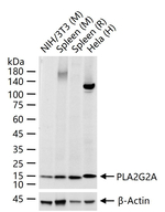 PLA2G2A Antibody in Western Blot (WB)