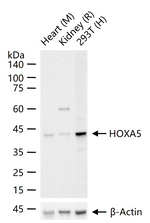 HOXA5 Recombinant Rabbit Monoclonal Antibody (3D2)