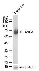 MICA Recombinant Rabbit Monoclonal Antibody (18A14)