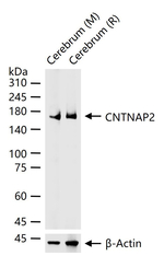 Caspr2 Antibody in Western Blot (WB)