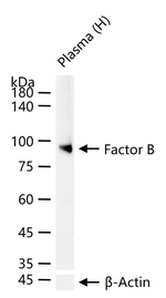 Complement Factor B Antibody in Western Blot (WB)