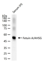 Fetuin A Recombinant Rabbit Monoclonal Antibody (14A13)