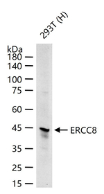 ERCC8 Recombinant Rabbit Monoclonal Antibody (18F8)