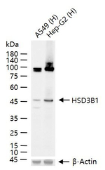 HSD3B1 Recombinant Rabbit Monoclonal Antibody (13C9)